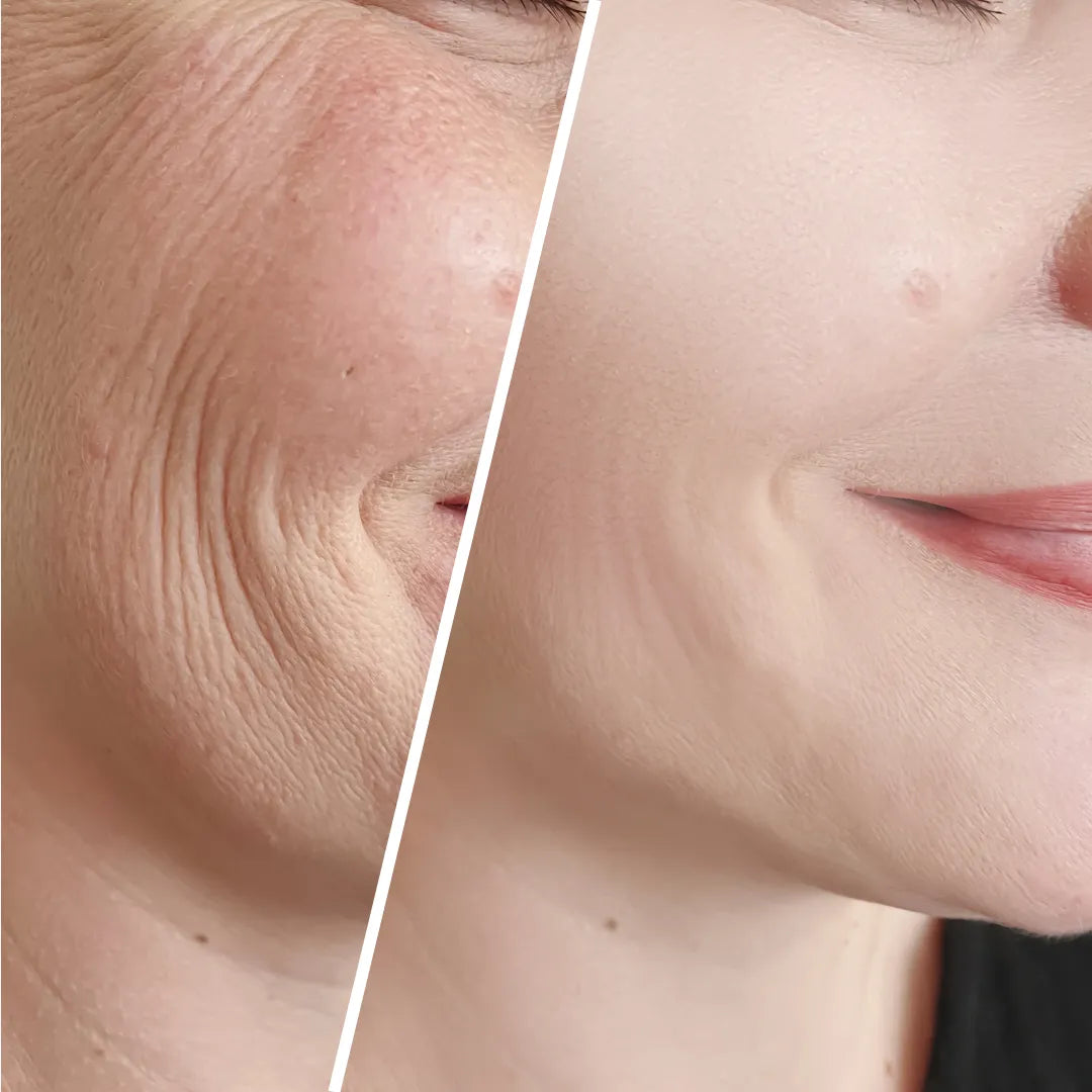 Hudpleje til sensitiv hud